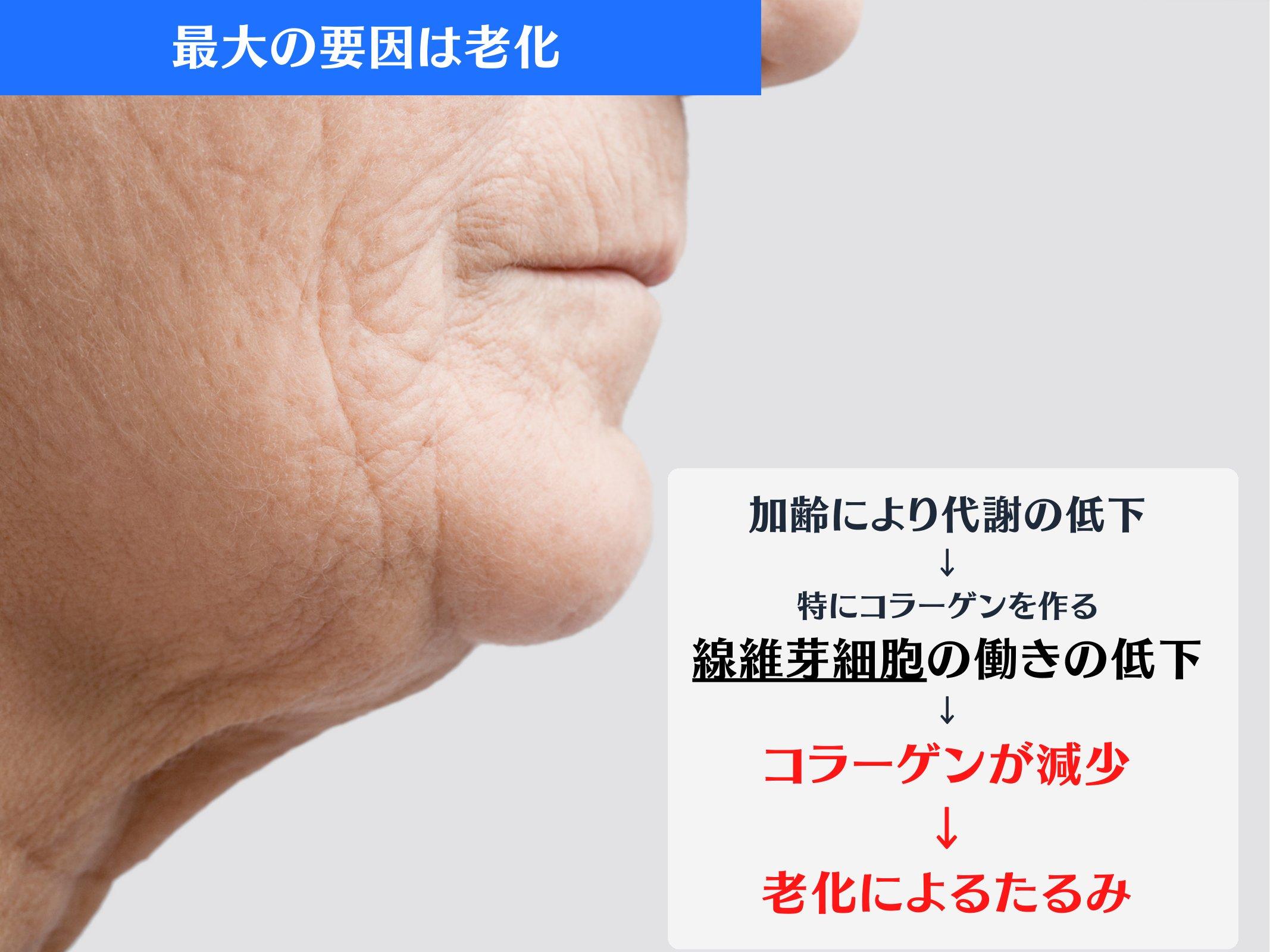 Slide 9