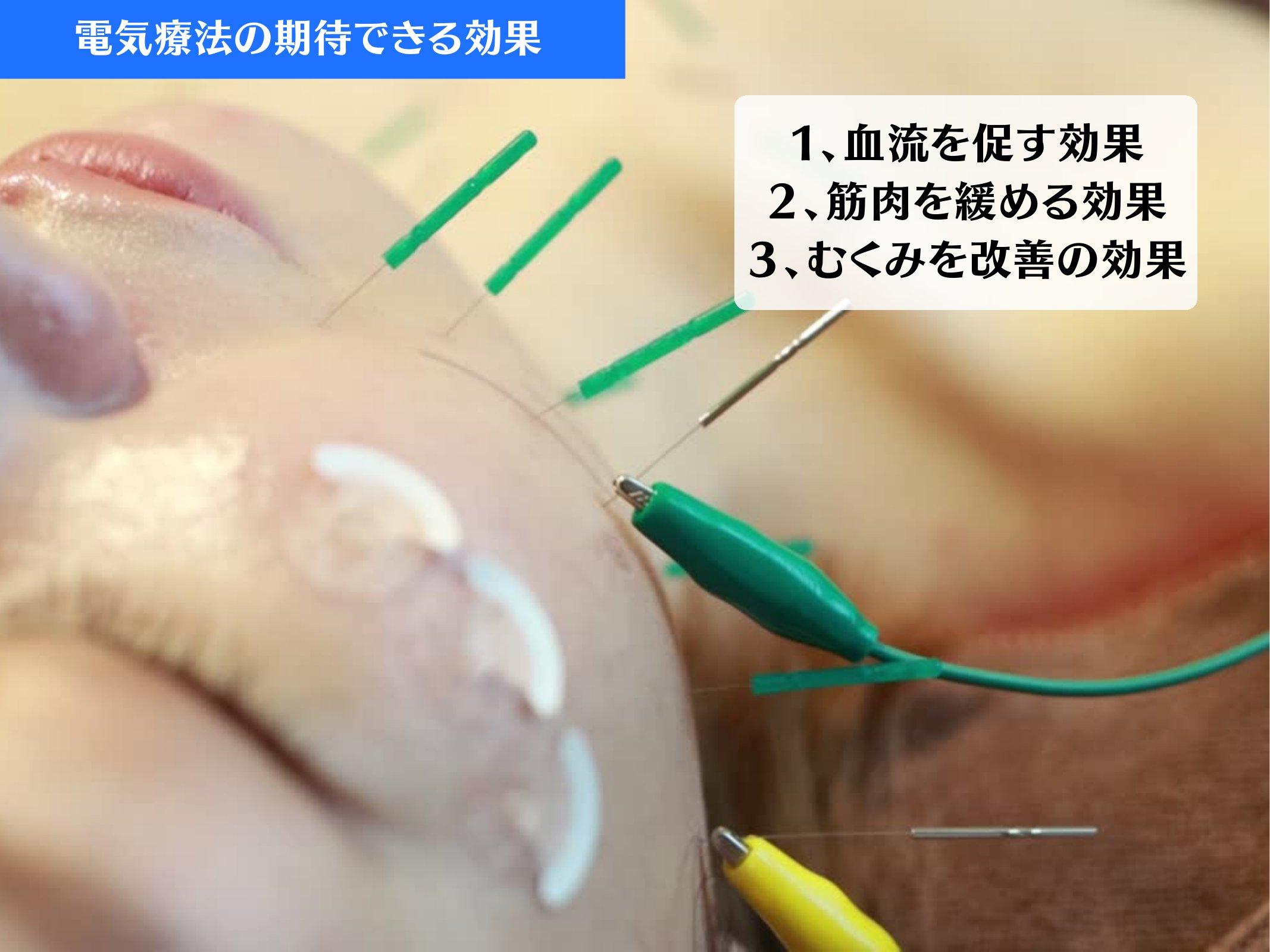 Slide 15