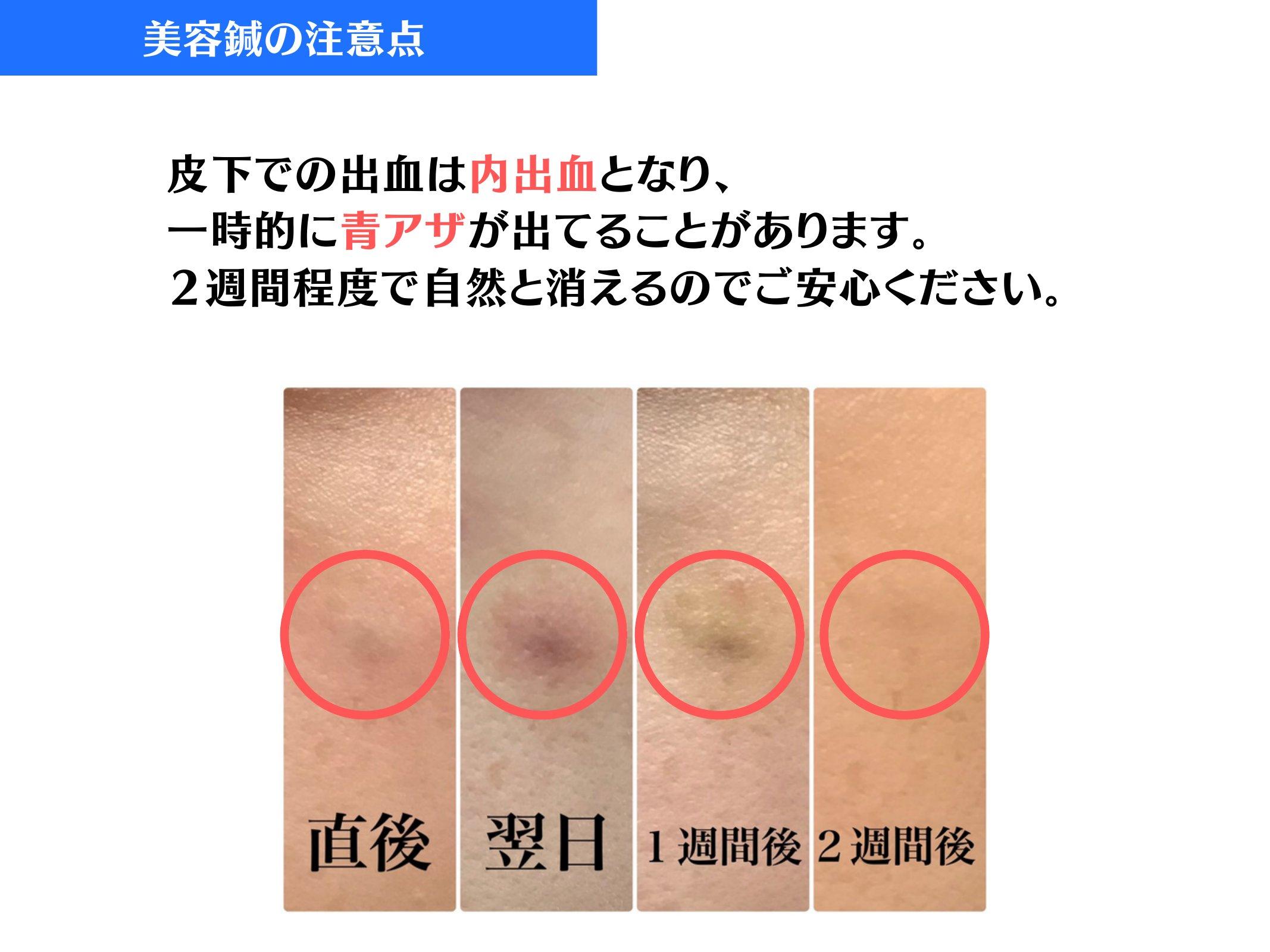 Slide 31