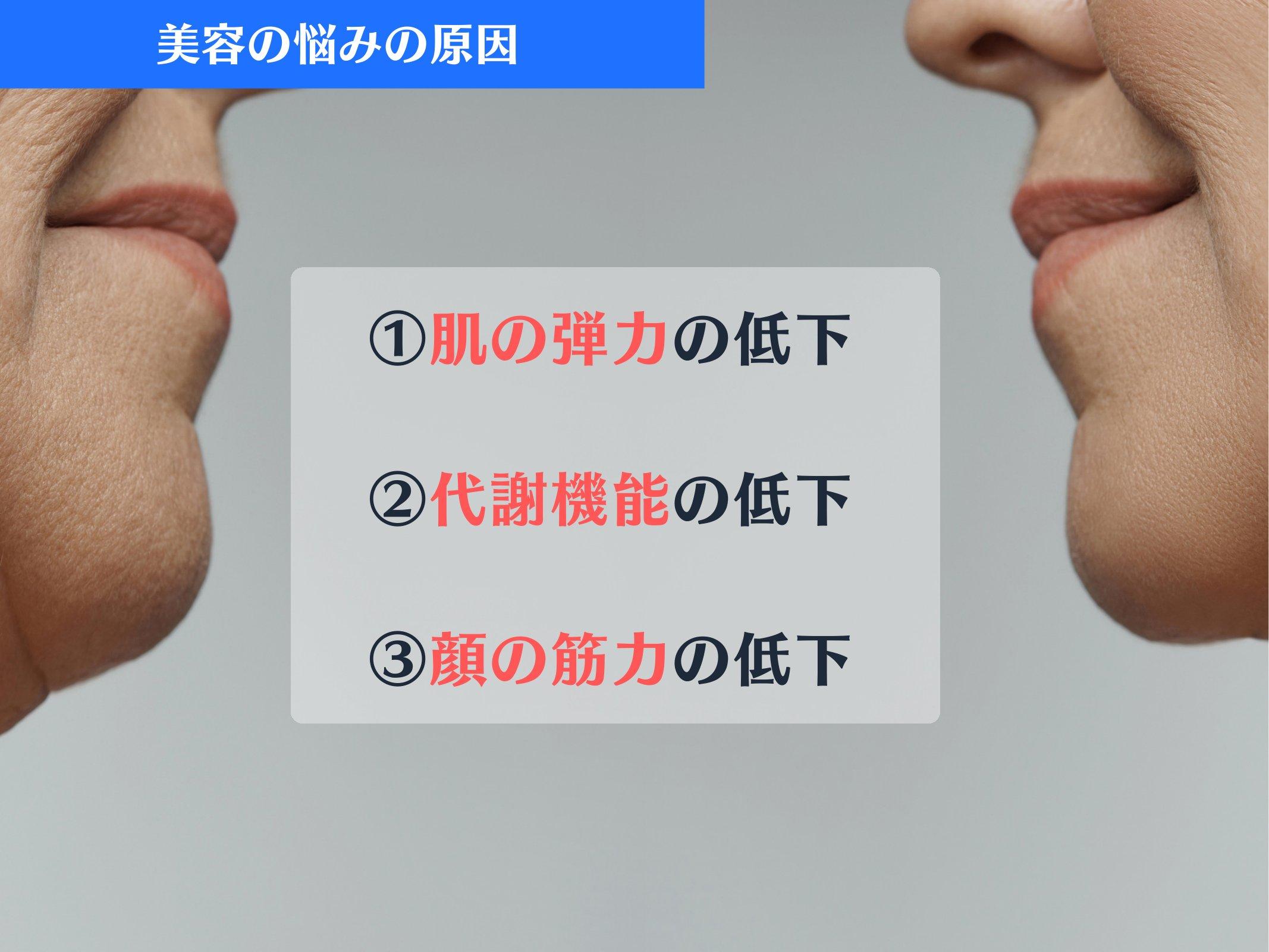 Slide 37