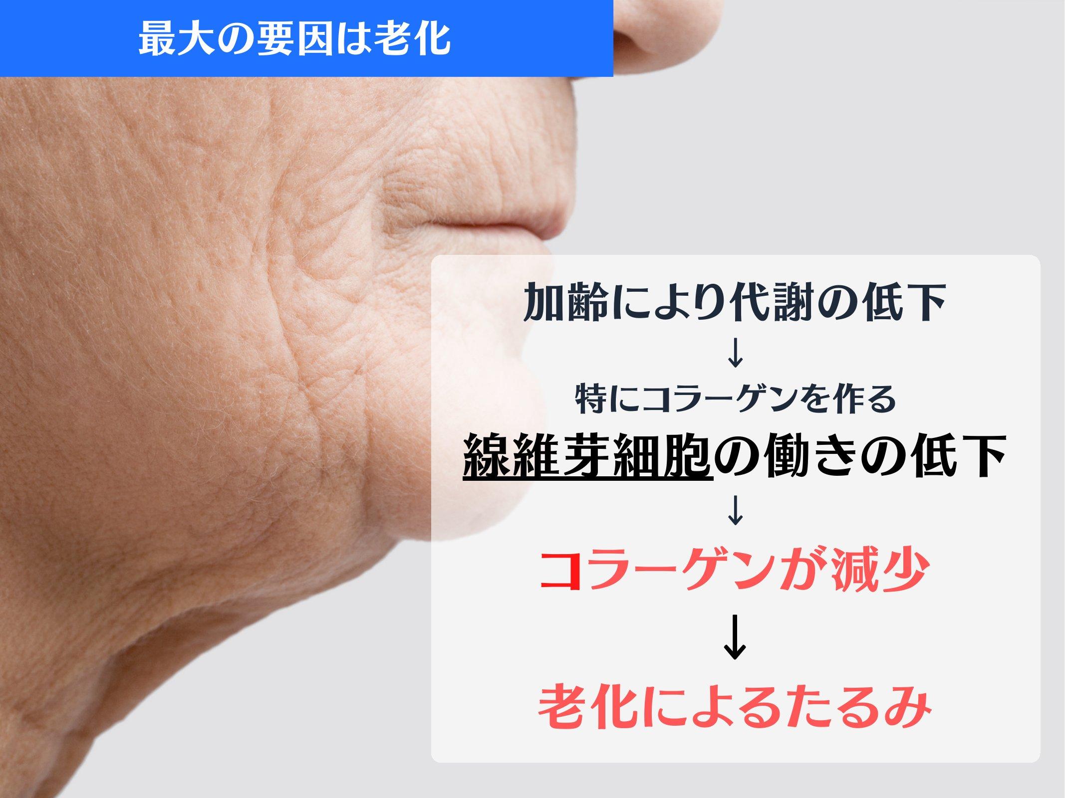 Slide 40