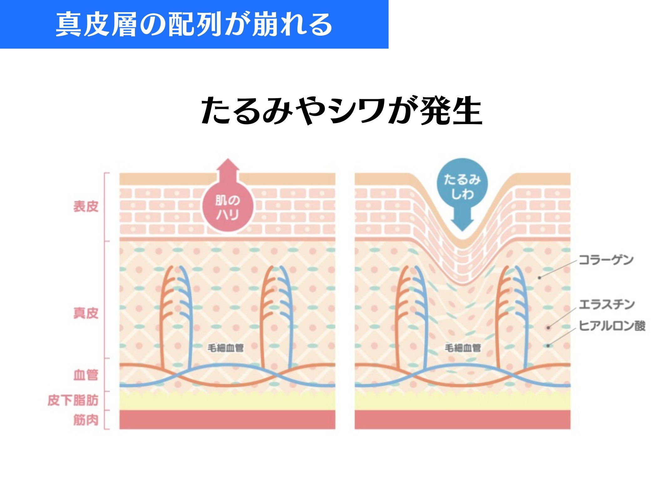 Slide 46