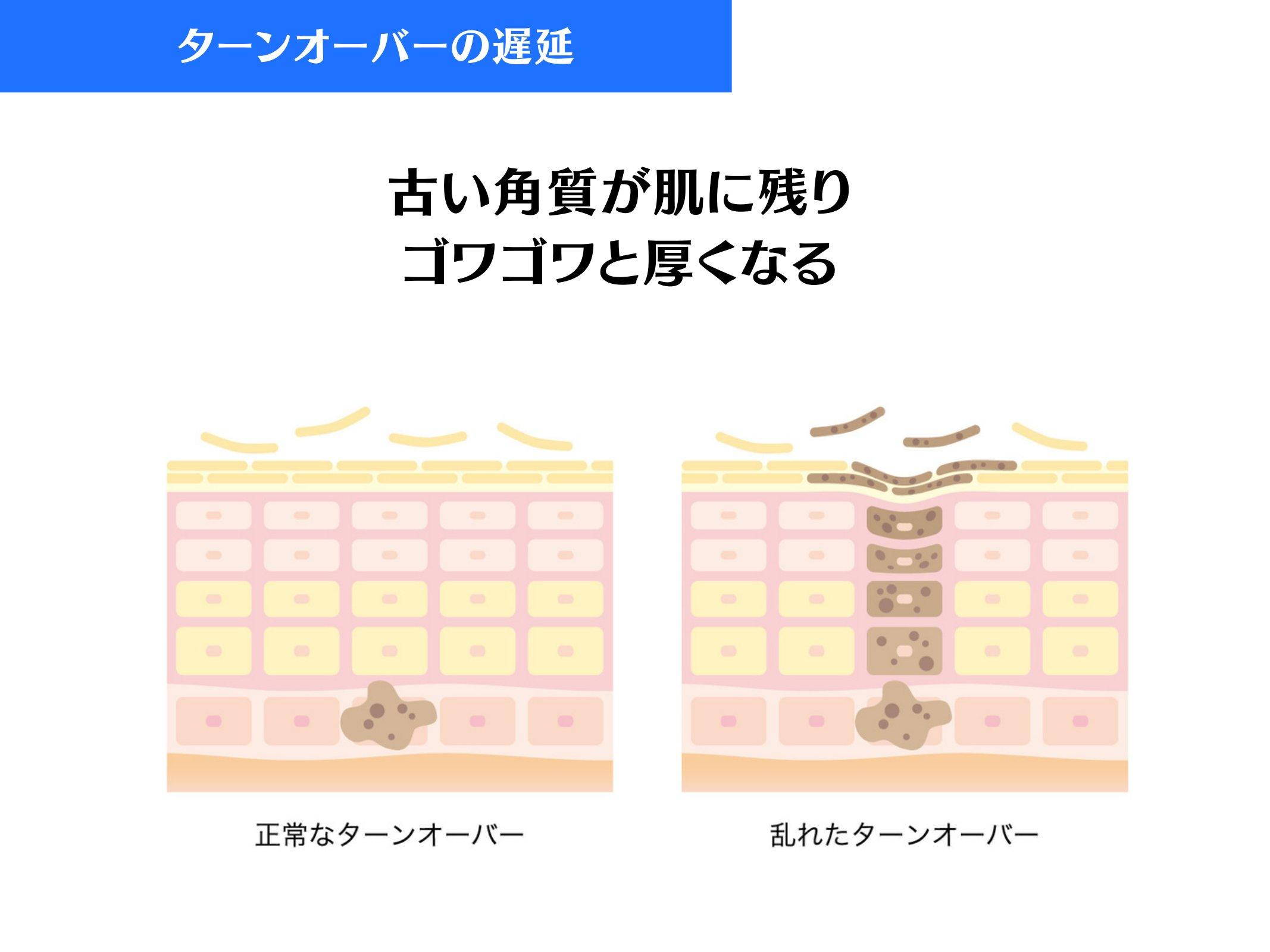 Slide 47