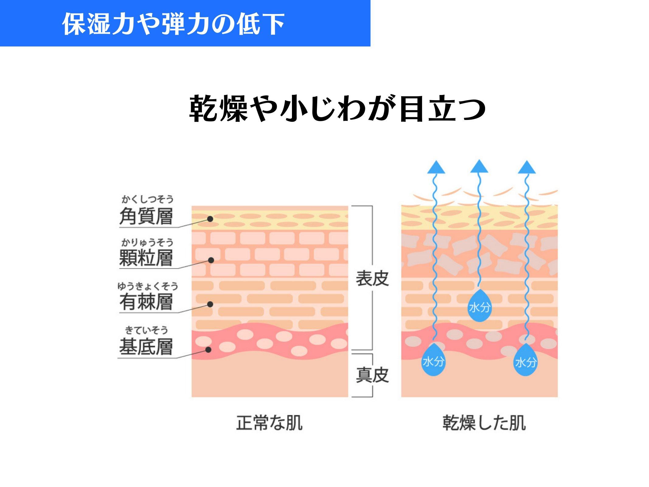 Slide 48