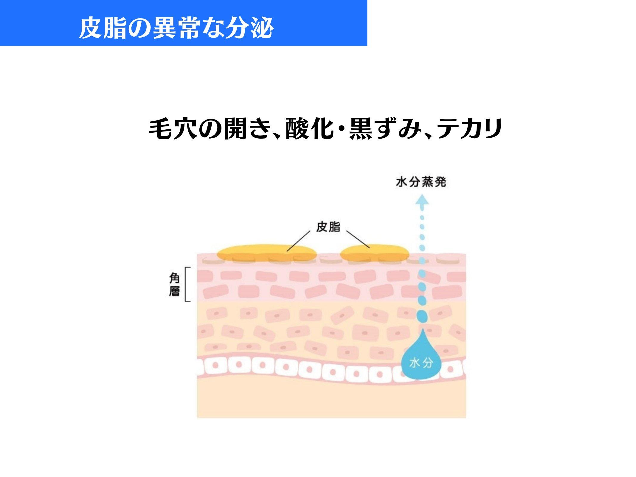 Slide 49