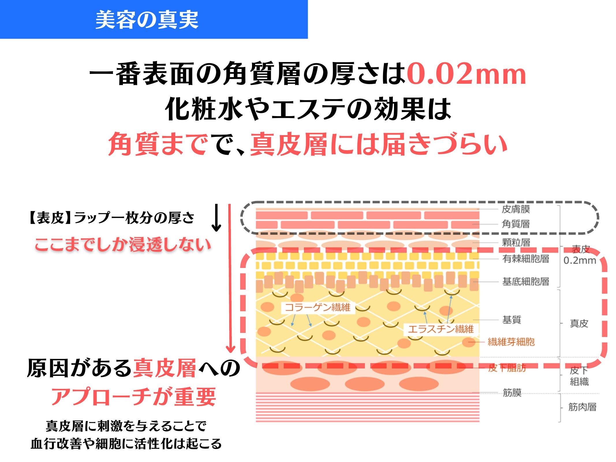 Slide 52