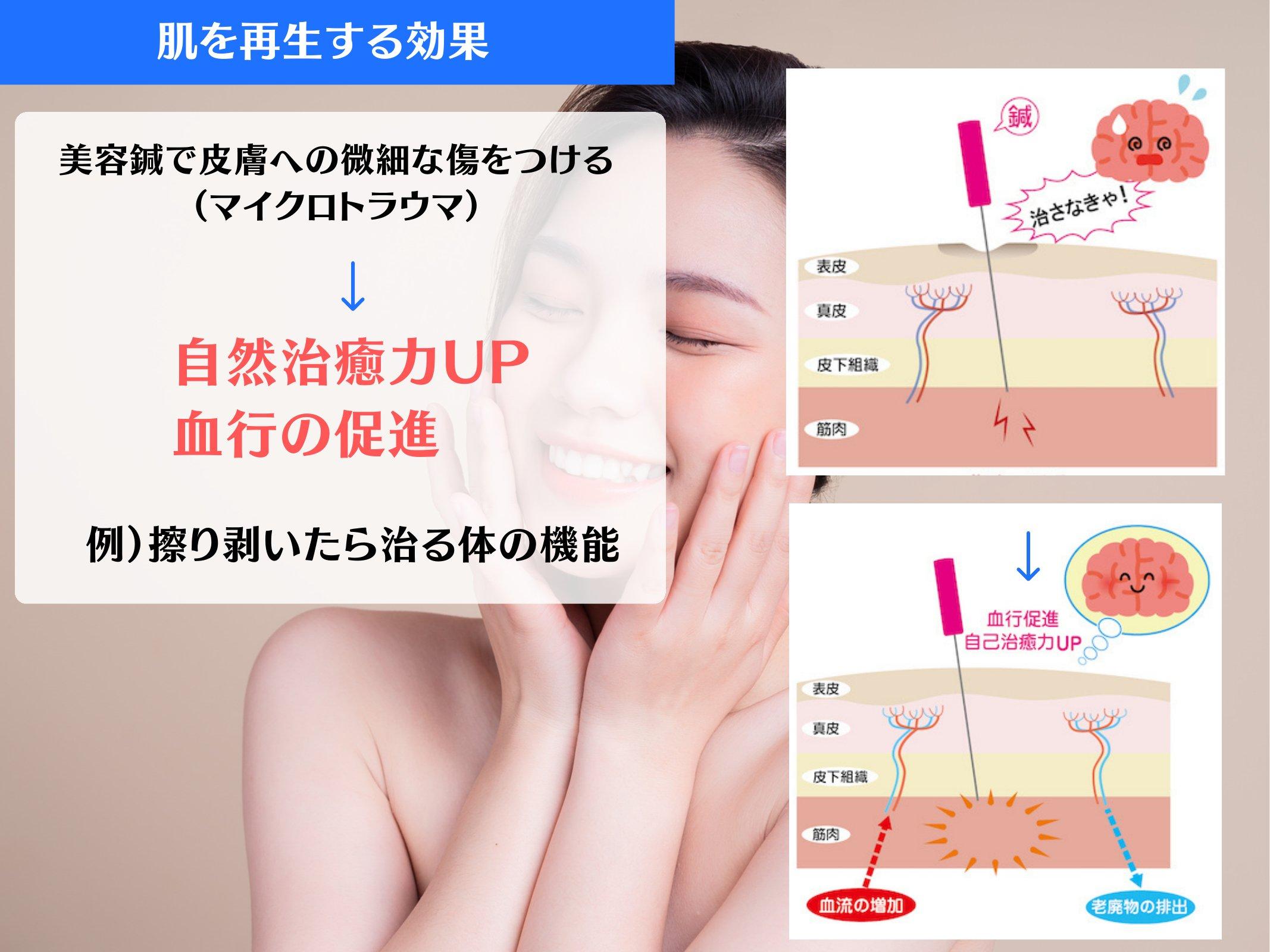Slide 58
